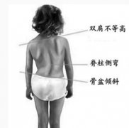 “葛优躺”脊椎承受负荷相当于平躺6倍！