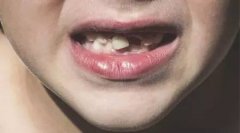 流汗就是流钙?补钙的正确打开方式快学起来!