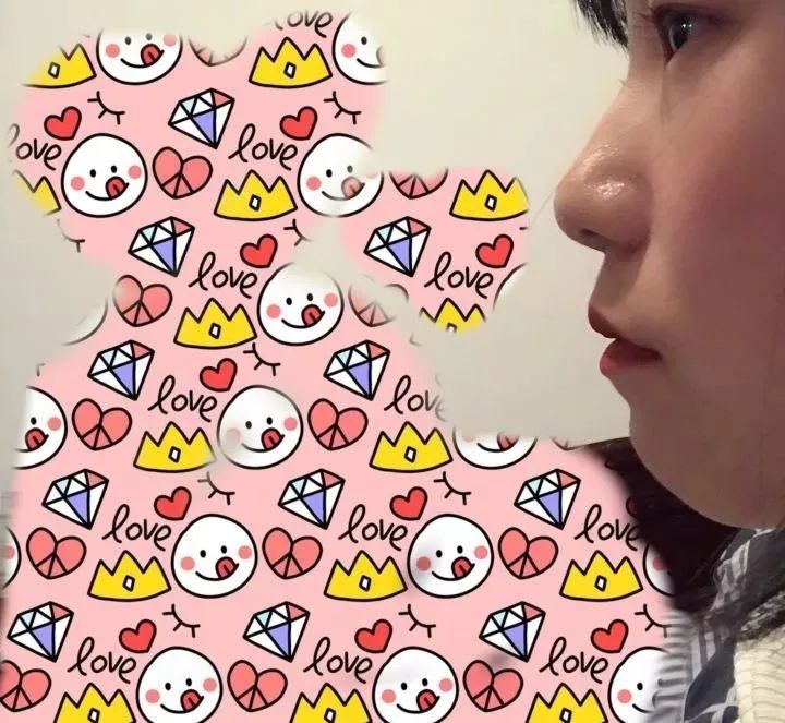 牙齿不整齐不能忍！小姐姐的牙套拯救日记